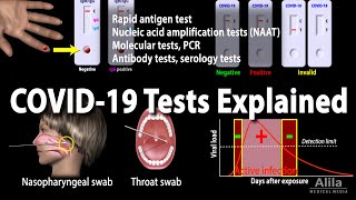 Multiplex Ligation Dependent Probe Amplification  MLPA  How To Perform MLPA [upl. by Irrabaj316]