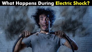 What Happens To Your Body When You Get Electric Shock  Electrical Injury UrduHindi [upl. by Dlorag]