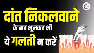 अपने दांतों को बचाएं दांत निकालने के बाद सही देखभाल है जरूरी What To Do After Extraction Of Teeth [upl. by Anirdnajela]