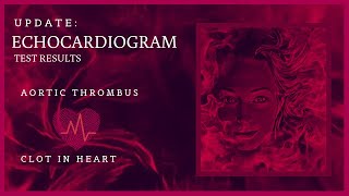 Echocardiogram Results for Blood Clot in my Heart Right Atrial Thrombus MPN Polycythemia Vera BCAM [upl. by Miarzim997]