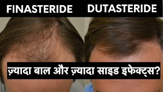 Finasteride vs Dutasteride in hindi  ये बातें कोई नहीं बताएगा [upl. by Lombardi]