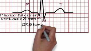 ECG Reading 1 [upl. by Ahseal889]