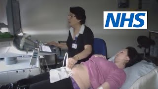 What happens at a scan and what will they tell me  NHS [upl. by Bessy]