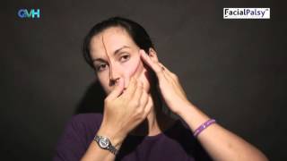 Facial Palsy DVD 1  Management of Flaccid Paralysis  Cheek Taping [upl. by Bud416]