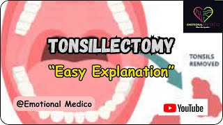 Tonsillectomy  Important points  ENT  emotionalmedico [upl. by Tiffy110]