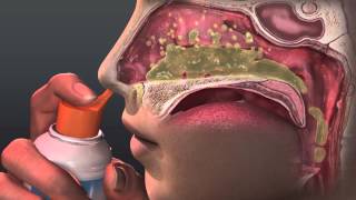 Can Saline Irrigation Help Nasal Allergies Animated Guide to Saline Nasal Irrigation [upl. by Annoet]