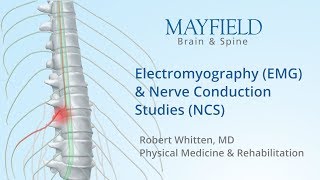 Electromyography EMG amp Nerve conduction studies NCS [upl. by Danby795]