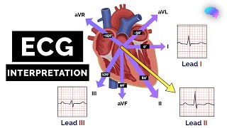 How to Read an ECG  ECG Interpretation  EKG  OSCE Guide  UKMLA  CPSA [upl. by Aslam]