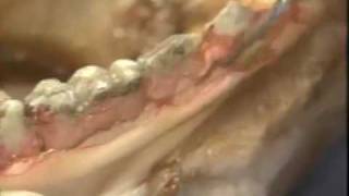 Introductory Periodontal Surgery Techniques Modified Widman Flap [upl. by Gnos]