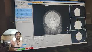 Venography MRI Contrast Explained MRVStep by Step on MRV plain as well as ContrastPart1 [upl. by Sami]