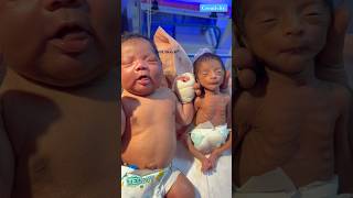 4600Gm And 1000gm😮😮medical cutebaby viralvideo [upl. by Nicolella812]