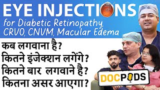 Eye Injections for Retina Treatments Explained  DocPods  Episode 1 [upl. by Atekan]