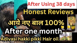 Adivasi Herbal hair oil l Honest Review l After using 38 Days adivasihairoil adivasihairoilreview [upl. by Hairahcez]