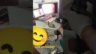 Endoscopy center live endoscopy [upl. by Naihtniroc364]