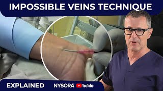 Difficult veins  Made Much Easier with this technique [upl. by Navlys]