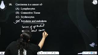 Carcinoma is a cancer of [upl. by Jaella]