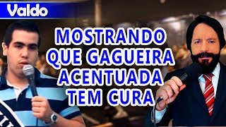 Valdo mostra que a gagueira acentuada tem cura [upl. by Keelin]