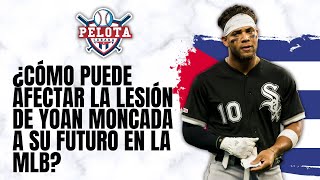 ¿Cómo puede afectar la lesión de Yoan Moncada su futuro en MLB [upl. by Zondra]