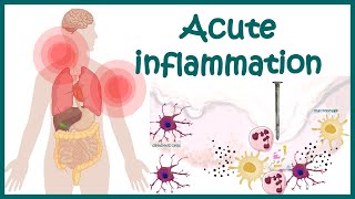 Acute Inflammation  symptoms Pathogenesis Cause of inflammation Mediators of Acute Inflammation [upl. by Jarlath]