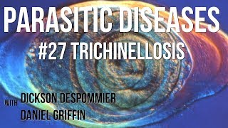 Parasitic Diseases Lectures 27 Trichinellosis [upl. by Attener838]