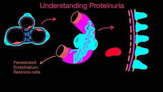 Proteinuria 1 [upl. by Ibbison]