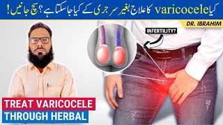 Varicocele Ka Ilaj  Treat Varicocele Naturally with Herbal Medicine  UrduHindi  Dr Ibrahim [upl. by Brittney70]