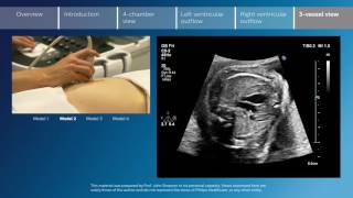 Key screening views of the fetal heart  Part 6  Vessel view [upl. by Lemert]