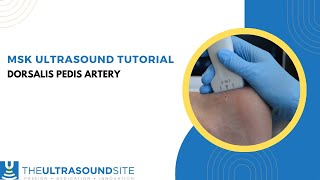 How to find the Dorsalis Pedis artery on MSK ultrasound of the foot [upl. by Ibbob]