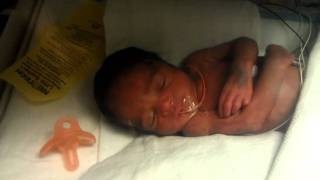 Baby Born at 30 weeks [upl. by Darsey]