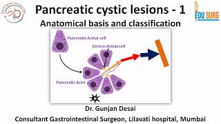 Pancreatic cystic neoplasms  Part 1  Anatomical basis and Classification [upl. by Yeca724]