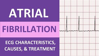 Atrial Fibrillation AFib ECG Treatment Causes Nursing NCLEX Review ACLS [upl. by Merth230]