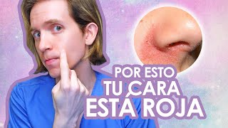 MINOXIDIL ¿CÓMO QUITAR LA RESEQUEDAD  TIPS MINOXIDIL  RESEQUEDAD EN LA BARBA [upl. by Fakieh947]