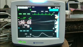 心電図モニター 実際の測定 Normal Sinus Rhythm洞調律 NIHONKOHDEN Vismo [upl. by Abernathy]