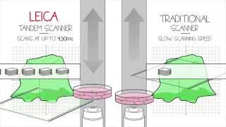 Leica SuperZ Galvometric Stage [upl. by Nashoma]