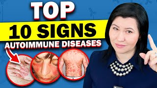 Top 10 Signs of Autoimmune Diseases  A Rheumatologists Guide [upl. by Tegdirb]