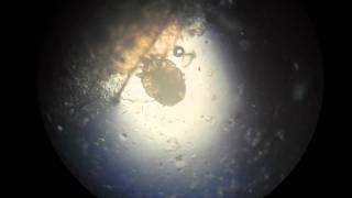 Scabies Mite Video HD [upl. by Yovonnda303]