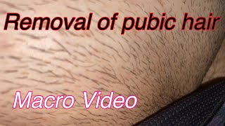 【Removal of pubic hair】アンダーヘアの処理 [upl. by Petrick335]