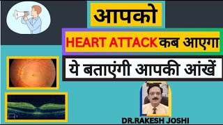 आपको HEART ATTACK कब आएगा ये बताएंगी आपकी आँखे [upl. by Tedric]