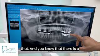 Understanding Panoramic XRays A Complete Dental Guide [upl. by Nylahsoj889]