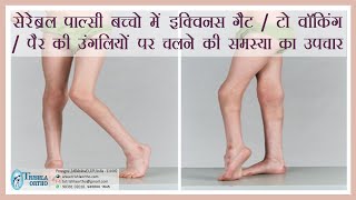 Treatment of Equinus gait toe walking walking on toes in cerebral palsy treatment at Trishla [upl. by Archaimbaud141]