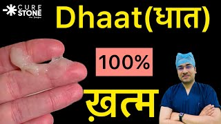 Dhaatधात 100 ख़तम  Dhaat Syndrome Hindi  धात रोग क्या और कैसे होता है  धात रोग का इलाज [upl. by Greer]