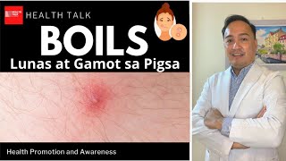 Boils Pigsa Causes Symptoms Treatment and Prevention [upl. by Folsom]