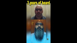 Beard Growth Update Week 3  Beard Growth Kit Copenhagen Grooming [upl. by Sholem]