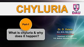 CHYLURIA  What is chyluria amp why does it happen [upl. by Inaffets]