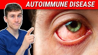 The SHOCKING Truth about Autoimmune Disease and Eye Health [upl. by Yelsew]