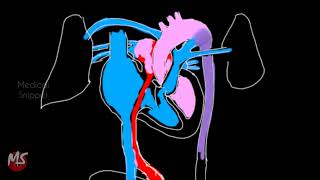 Fetal Circulation  Anatomy  Made easy  3 minutes [upl. by Atcliffe]