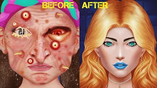 ASMR Removal pimples Psoriasis amp Infected face  Severely Injured Animation [upl. by Barbette]