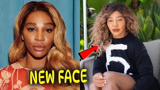 Serena Williams’ Heavily Criticized By Fans As She Looks Unrecognizable With Her NEW FACE [upl. by Hermione]