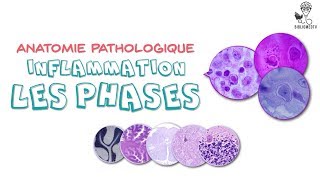 Anatomie Pathologique  Phases de lInflammation [upl. by Yekim]