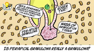 What is periapical granuloma [upl. by Adall896]